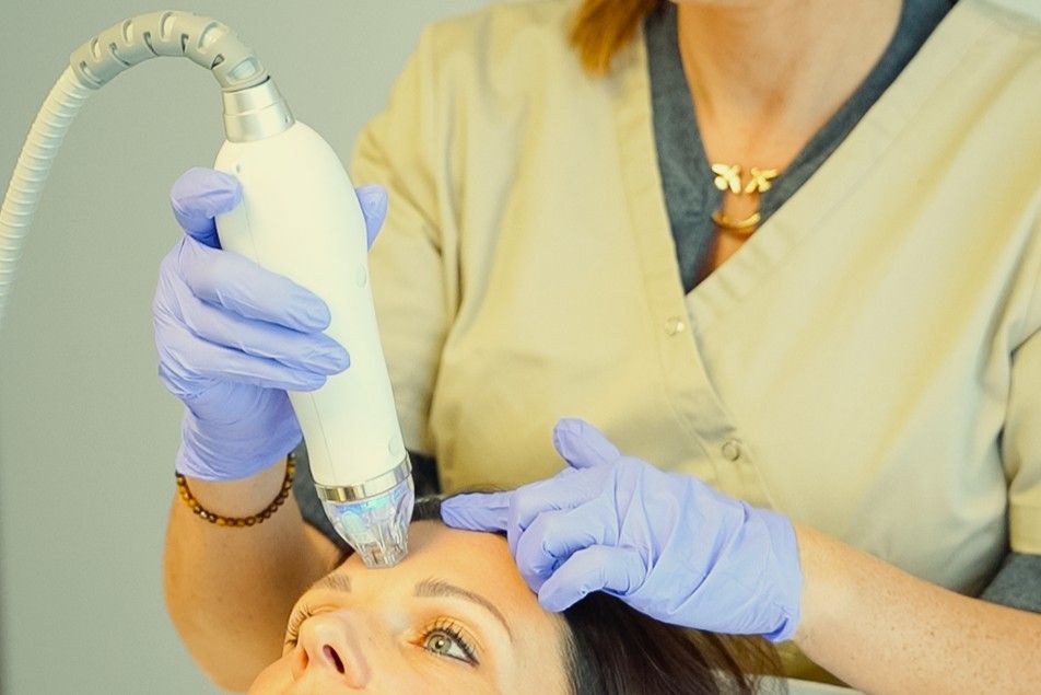 RF microneedling