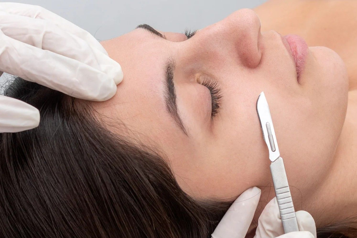 Dermaplaning