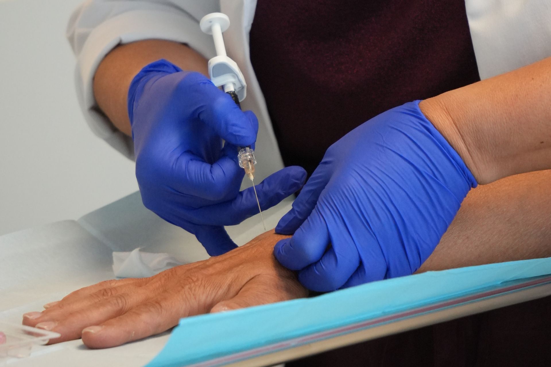 Huidverbetering viscoderm handen