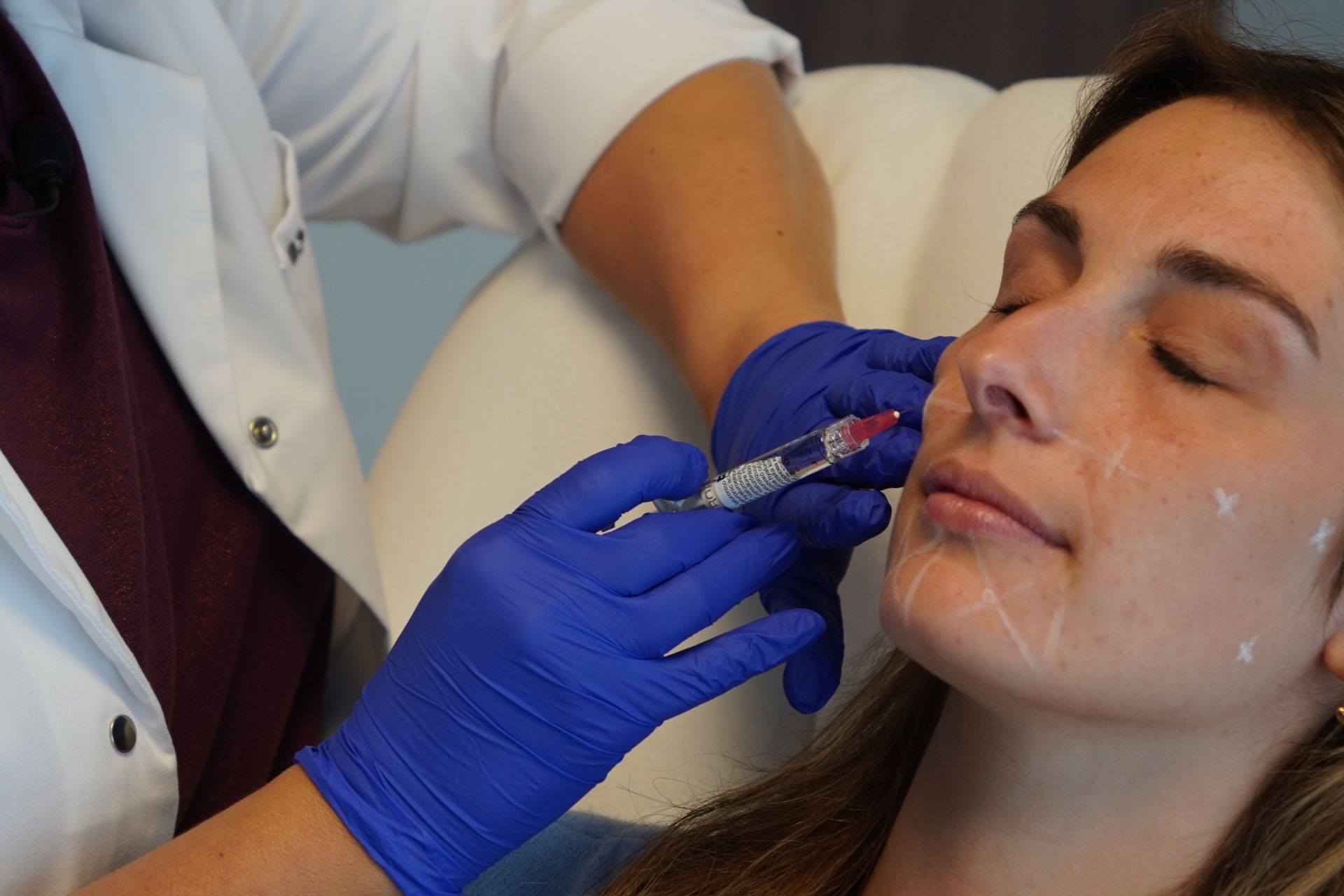 Huidverbetering Viscoderm 